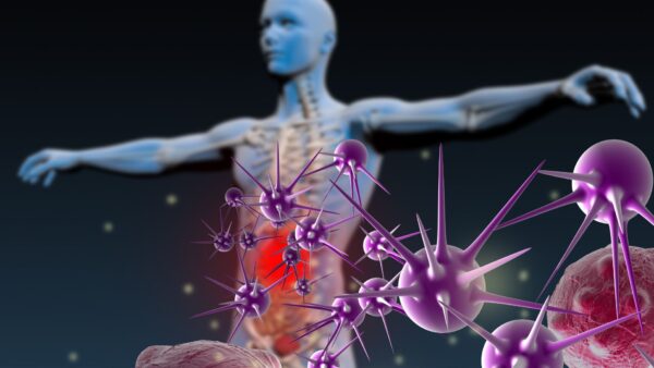 O que é doença autoimune? Como diagnosticar e tratar?